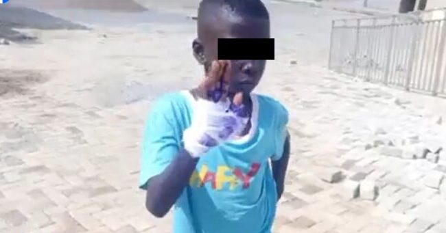 Policeman allegedly burns 11-year-old boy’s palm over GH₵2