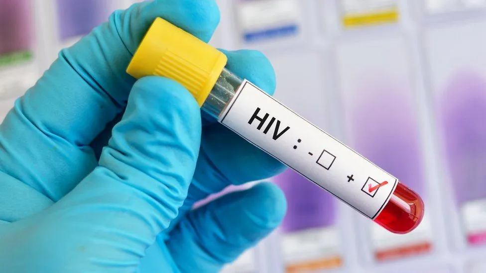 Ghana spent over USD 127m to address HIV